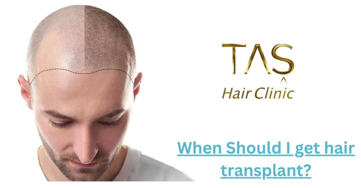 Best age to get hair transplant