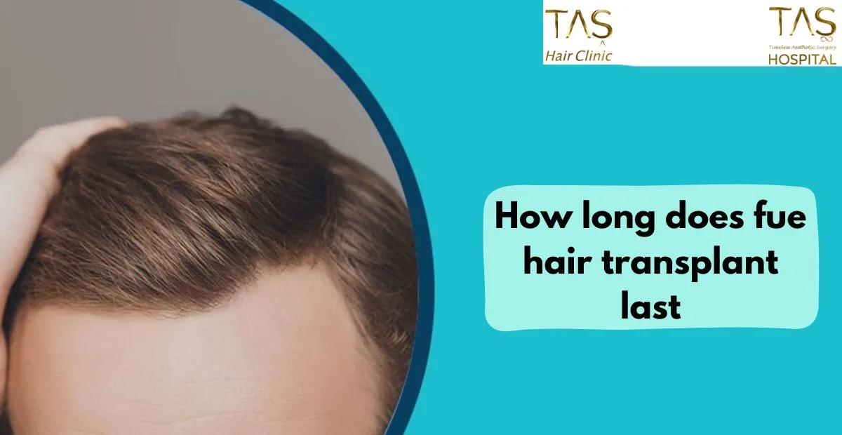 How long does fue hair transplant last - TAŞ Hair Clinic
