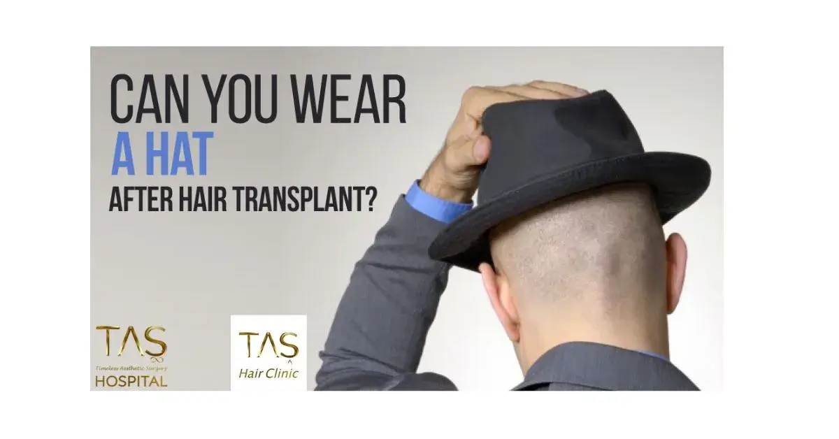 Wearing hat after hair transplant